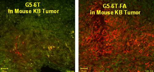 Confocal microscopy of cryosectioned tumor samples from SCID mice